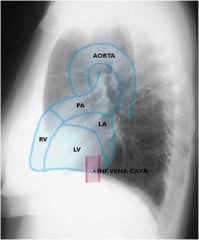 Anterior cardiac border - right ventricle

Posterior cardiac border -  LV and LA  

The IVC is seen best on lateral projection.  The posterior border is evident in contrast to the air-filled lungs.