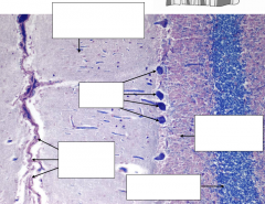 Identify the following structures in the sheep cerebellum