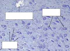 Identify the blanks in the following sheep brainstem grey matter