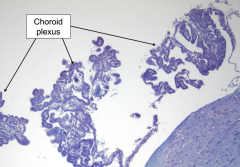 Choroid plexus - produces CSF