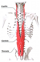 (også thoracis og capitis)


Ekstension, lateral fleksion af rygsøjle og nakke. Rotation af hovedet.


Longissimus er placeret længere væk fra rygsøjlen end spinalis. Den hæfter på tværtappe og ribben. 


Udspring: processus transver...