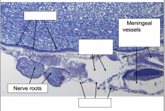 Identify the following meningeal layers of the sheep brain stem
