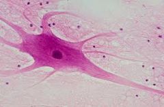 several dendrites one axon MOST nerves of brain and spinal cord are this type