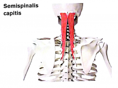 (også thoracis og cervicis)


Ekstension og rotation af rygsøjle og nakke Udspring: processus transversi af T6-C4 Insertion: os occipital, under linea nuchalis superior
