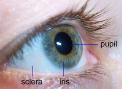 Pupil Abnormalities