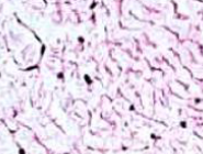 - Netværk af fibroblaster 
- Indeholder proteoglycans og GAGs 
- Gele lignende grund substans 
- Indeholder kollagene fibre 
- Findes i navlestrengen hos fostre