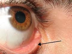 the junction of the skin and the conjunctiva