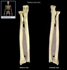 What bone structure is highlighted? 
