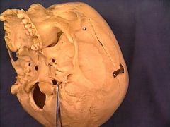 the facial nerve and stylomastoid artery 
