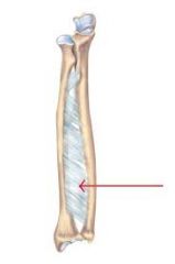 Sheet of connective tissue between the radius and ulna (forearm) or the fibula and tibia (leg).- Increases surface area for muscle attachment- Forms a fibrous syndesmosis joint between the two bones