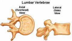 Body- Large, kidney-shaped
Vertebral Foramen- Triangular
Spinous Processes- short, blunt, hatchet- shaped; projects directly posteriorly 
transverse processes- thin and tapered