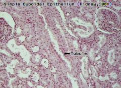 cells of kidney tubules:


- Loop of Henle ( Descending / Ascending)


- Distal Convoluted Tubule