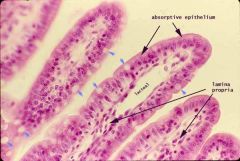 - lining of the 
small intestine 
(microvilli)


- Jejunum