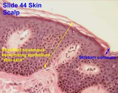 - Epidermis of skin
(scalp)


- Lining of esophagus