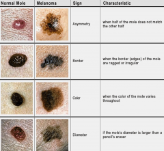 Malignant melanoma (MM)