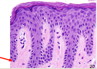 Two weeks = maturation
Shed two weeks after reaching stratum corneum (28-day cycle)
 
Basal layer = source of epidermal cells where CELL DIVISION occurs