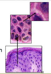 What cell types is shown here? what makes of the majority of cells? What are they held together by? In which layer are these primarily visible?