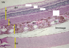 Identify the following layers of the sheep eyeball retina