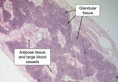 What tissue is the following a histological section of?