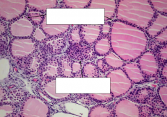 Identify the following types of cells/structures in the thyroid gland