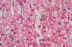 The following image is of the detail of the cells found in the adrenal cortex. Why do they appear 'foamy'?


 