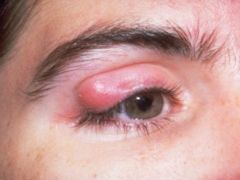 Identify this condition.