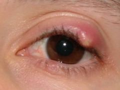 Identify this condition.
