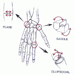 Plane type synovial joint