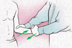 Internal rotation test:
- Tests for injury / tear of the subscapularis