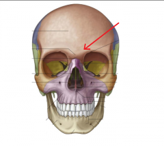 Name this bony marking. It falls just below the eyebrows and helps to form the orbit. 