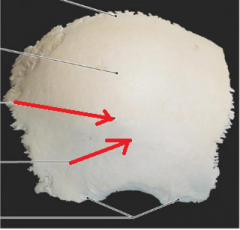 Name the bony markings. These are the origin of the temporalis m. 
