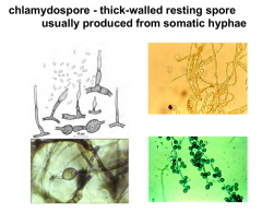 Thick-walled resting spore usually produced from somatic hyphae

Arbuscular mycorrhizae spores are a good example