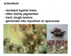Resistant hyphal mass that will germinate into a mycelium of sporocarp