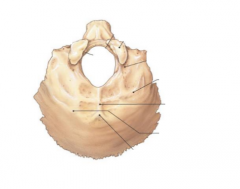 Occipital Bone 