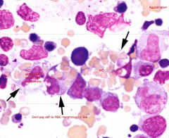 Anemia in animal was NON-REGENERATIVE so a BM aspirate was conducted. 
Dx:
What supports your answer?
Why is it non-regenerative?