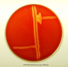 CAMP test        Listeria monocytogenes shows an enhanced zone of hemolysis, forming an arrow head towards the S. aureus culture