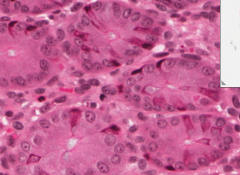 Vilka celler syns förutom cylindriska epitelceller (mörkrosa)?