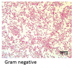 - Have a thinner PNG (peptidoglycan) layer 
- Does not retain crystal violet 
- Can be counter-stained pink by safranin