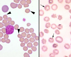 Identify the parasite.
If anemia is non-regenerative, what tests are indicated?