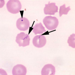 Identify the structures/parasites:
1. 
2. 
What factors predispose animals to Mycoplasma haemocanis?