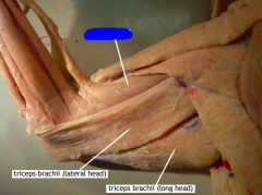 Movement: flexes the antebrachium (forearm) the blue one