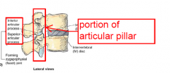 portion of articular pillar