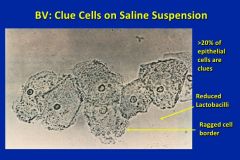 clue cells bei Aminkolpitis