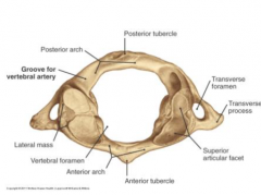 Anterior Tubercle of C1