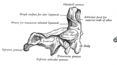 Articular facet for anterior arch of C1