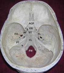 clivus (basi-occiput) of occipital bone