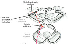 medial geniculate nucleus


brachium of inferior colliculus