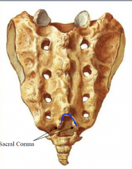 sacral cornua