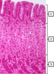 What is/are the predominant cell type(s) in the indicated areas of gastric mucosa?