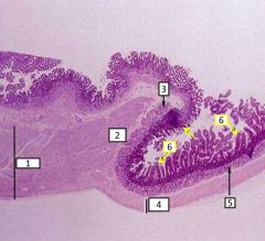 Gastroduodenal junction